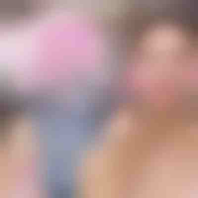 Arcmasszírozó jéggolyók (2 db) | GLACIE